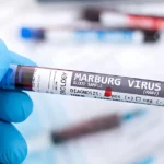 Daily Jotting blog post about the Marburg Virus news.