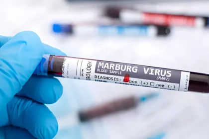 Daily Jotting blog post about the Marburg Virus news.