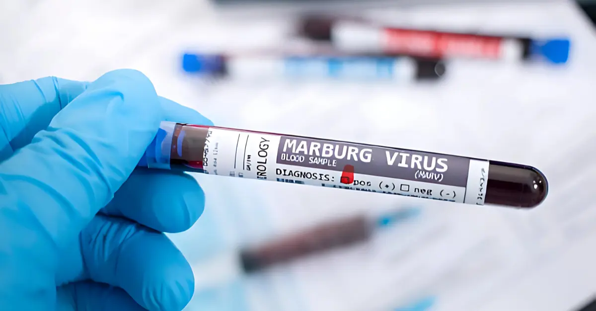 Daily Jotting blog post about the Marburg Virus news.